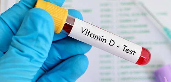 B-vitaminer viktige for mange av kroppens funksjoner